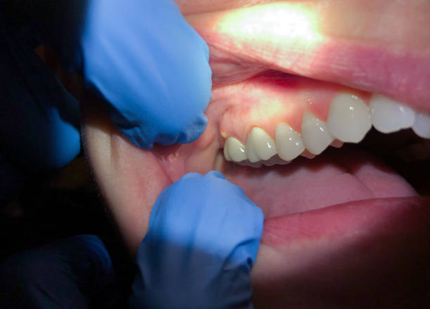 Best Pediatric Emergency Dentist in Shenorock, NY
